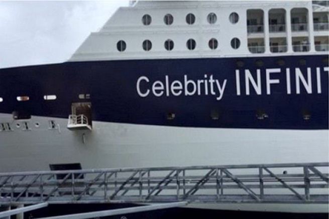 La cuffia Celebrity Infinity perde la sua manovra